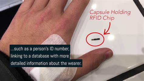 what hand takes rfid chip|dangers of microchipping humans.